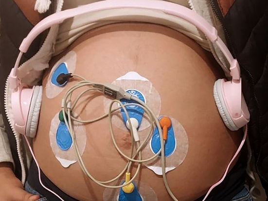 Investigadores UAEMéx revisan efecto de la música en actividad cardiaca fetal