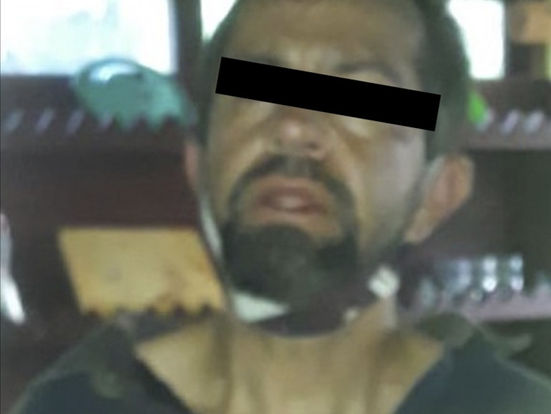 Sujeto corta parte de la lengua a mujer y le tira los dientes a golpes