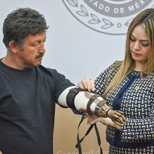 Promueve Jennifer González colaboración para entrega de prótesis