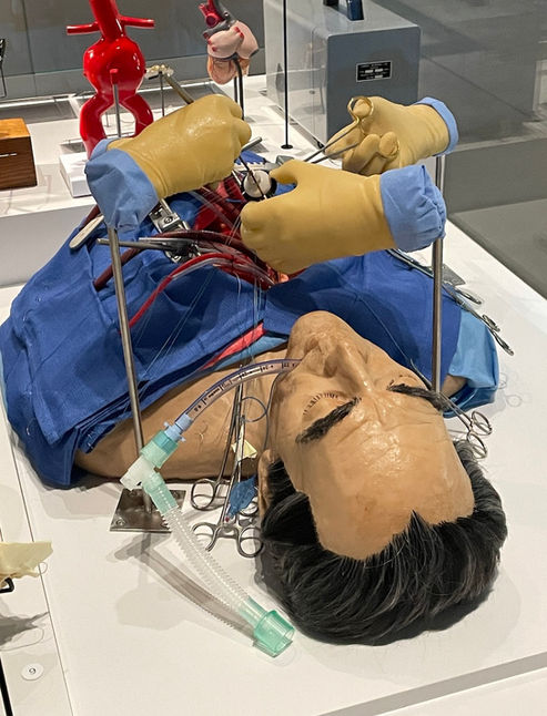 Hunterian Mitral Valve Surgery model.jpg