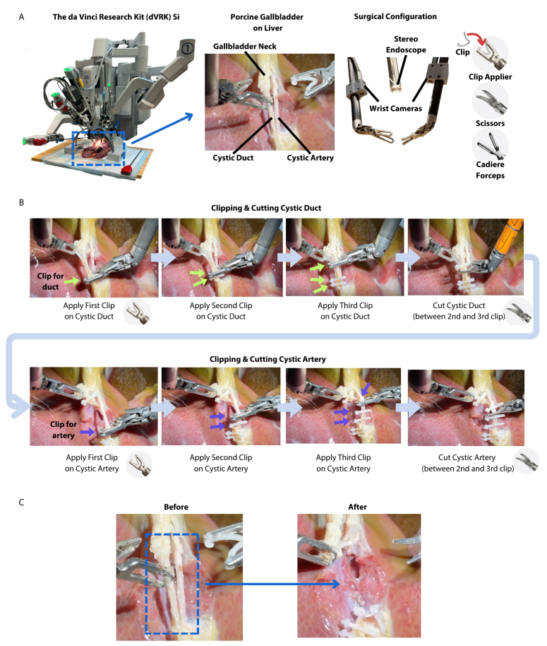 System and task overview. (A) We use the da Vinci Research Kit (dVRK) Si to deploy their policy, which includes an endoscope and two additional wrist cameras mounted for a better view of the interactions between instruments and tissue. (B) The autonomous surgical steps include clipping and cutting the gallbladder’s artery and duct. (C) The before and after pictures illustrate the objective of this procedure; the duct and artery are completely severed, without spilling any of their internal fluids thanks to the use of clips.