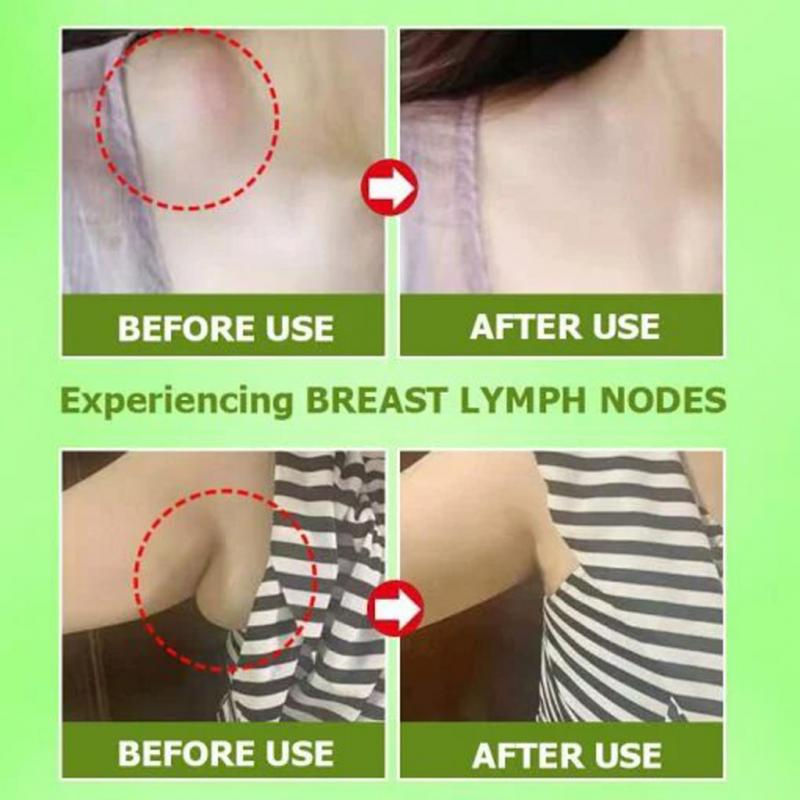 Thumbnail: 5-20pcs Herbal Lymph Care Patch Neck Anti-Swelling Stickers Vice Breast Lymph