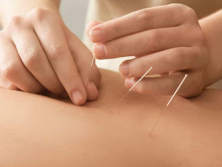 Dry Needling, what does it do?