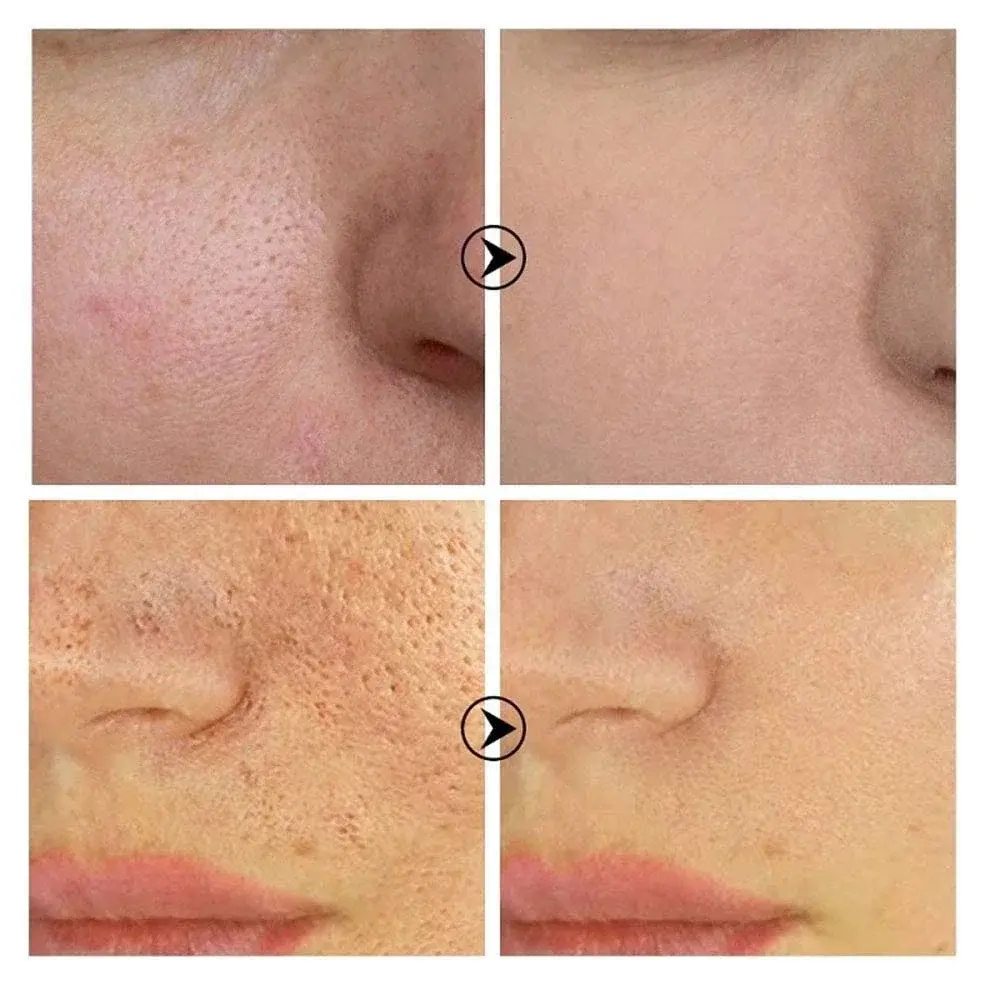 Skin Texture | Pore Refining Resurfacing, Brightening Facial Serum with Retinol 