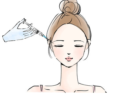 ボトックス注射で表情ジワを改善する女性のイラスト