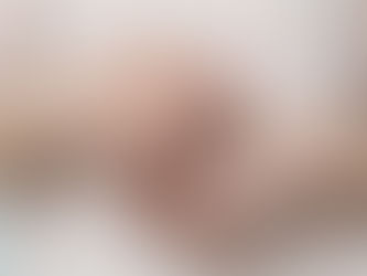 BARRA DO PIRAÍ TEM PRIMEIRO CASO CONFIRMADO DE 'VARÍOLA DOS MACACOS'