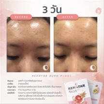 renatar-aura-plus-review-8-400x400.jpg