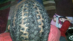 Retwist and Braids