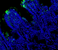 globet ileum_edited.png