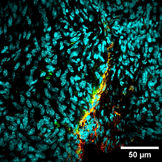 ventral pgp cgrp_60X_zoom1x__0005 1.png