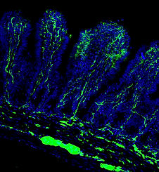 PGP 9_edited_edited.jpg