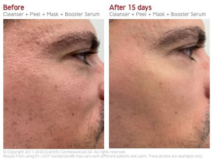 Planches Before-After #Flawless Velvet S