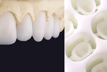 White Lemon milled and wax up-2_edited_e
