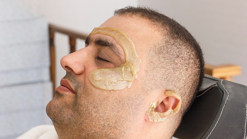 Man receiving temple and ear facial hair removal wax. This represents facial wax services available at Apricity Aesthetics® - Brixton & Clapham, South London, England UK