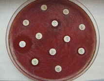 Quelle est la différence entre les probiotiques, les prébiotiques et les antibiotiques?