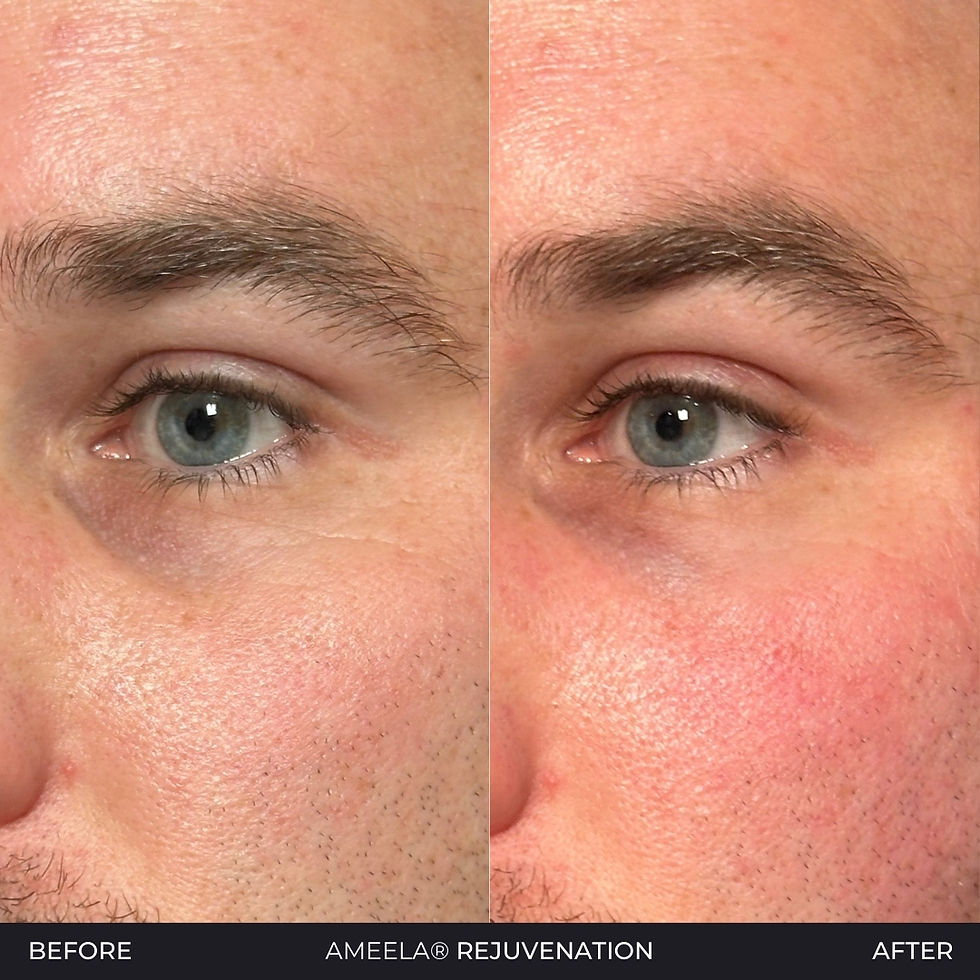 Men's Aesthetic Treatments, Ameela Polyneucleotides