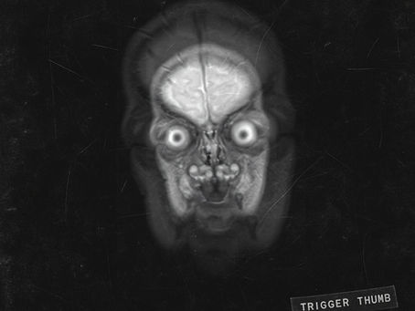 REVIEW: Trigger Thumb - PMP-EP