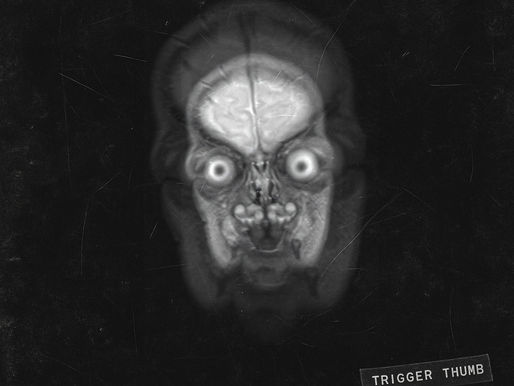 REVIEW: Trigger Thumb - PMP-EP