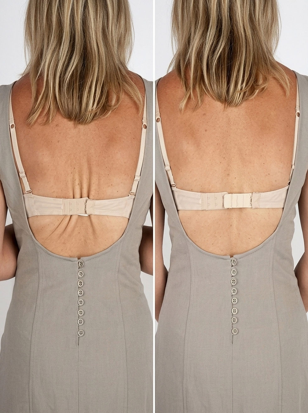 Thumbnail: BRA EXTENDER - 1 HOOK (36-PCS)