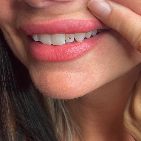 SMUG Tooth Gems Winnipeg