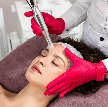 microneedlingcardiff.jpg