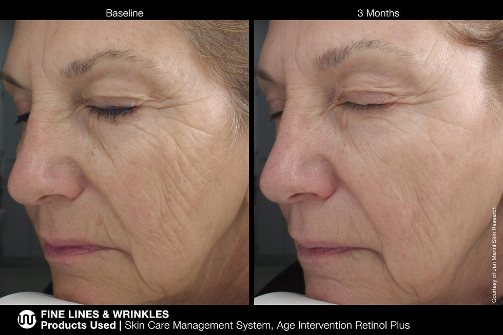 Thumbnail: JAN MARINI AGE INTERVENTION RETINOL PLUS MD