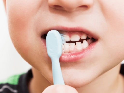 Caries en menores alcanza 43,9% en la región de Antofagasta: llaman a reforzar la higiene bucal desde la infancia