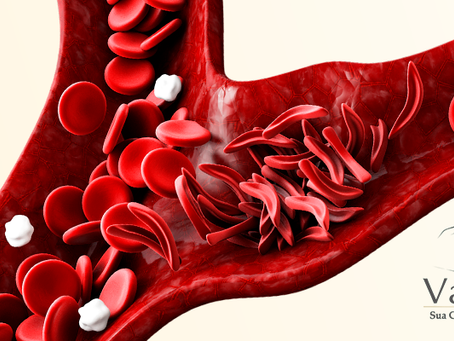 Existe diferença ao vacinar crianças com Anemia Falciforme?