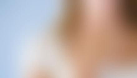 Disfonia (Rouquidão)