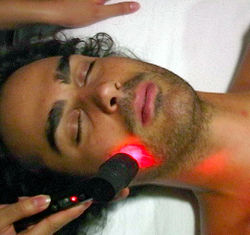 rayo-laser-facial