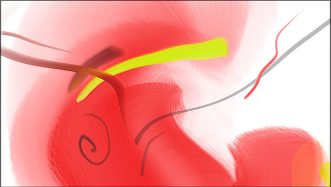 TCKLNGRED1A-30x17-1530
