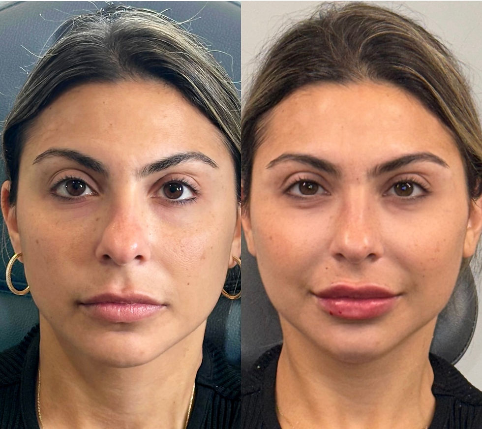 Facial Balancing