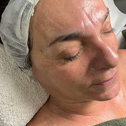 ExosRescue – fraxface+dermapen+exosomas | Maquillaje, Peinados y Skincare para Bodas | GlowStudio by LuliJaimeMUA ✨