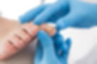 fungal nail.jpg