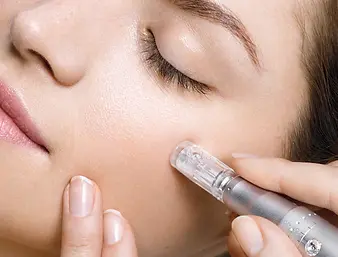 microneedling1_600x600.webp