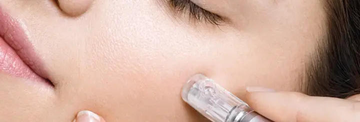 microneedling1_600x600.webp