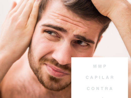 MMP Capilar contra a calvície
