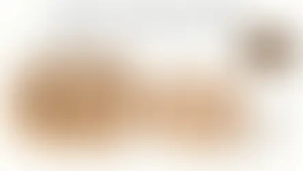 Ilustração comparando couro cabeludo com fios terminais e área com miniaturização dos fios, sobre queda de cabelo feminina e o que o exame revela