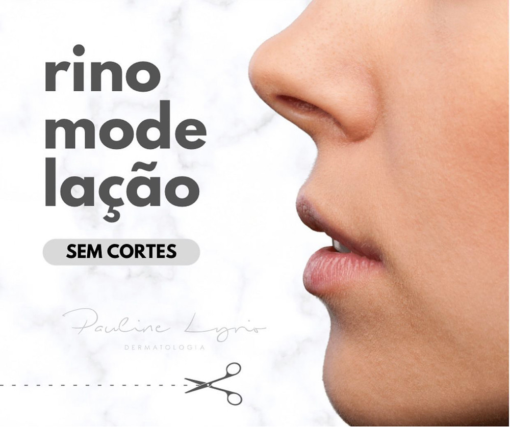 bioplastia de nariz rinomodulação