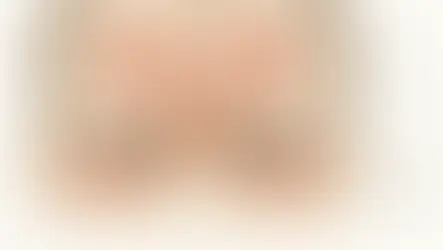 Ilustração da musculatura da testa, da glabela e ao redor dos olhos em um rosto masculino esquemático