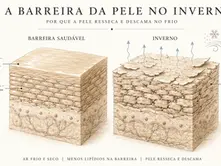Eczema de inverno (asteatose): por que a pele resseca e descama no frio