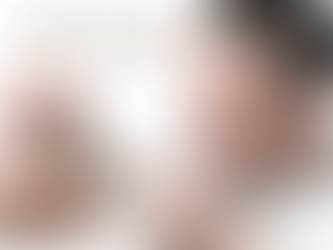 Maioria dos casos de Calvície começa entre 24 e 26 anos