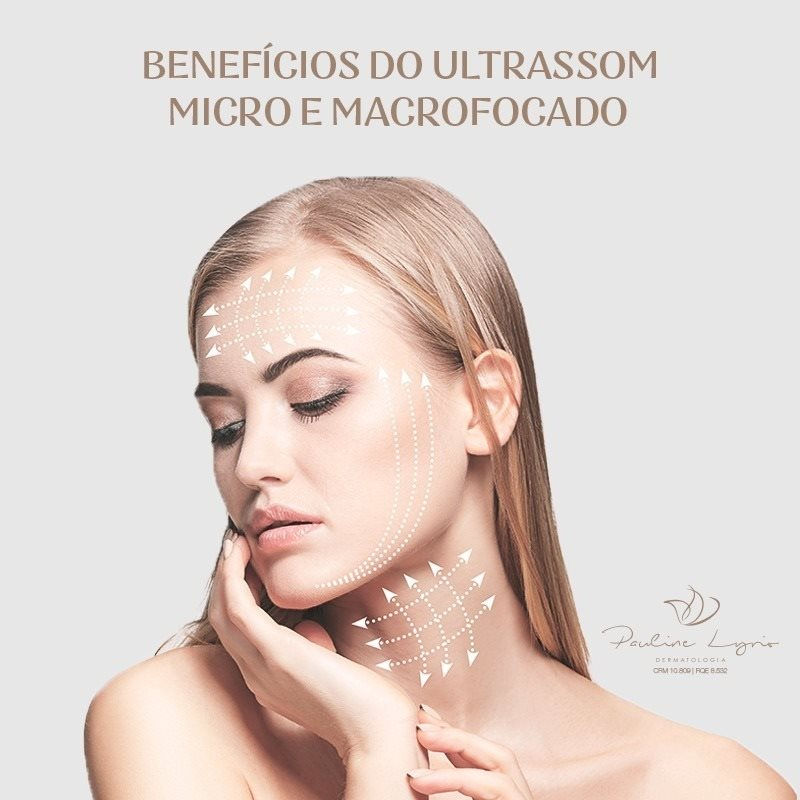 Benefícios do ultraformer