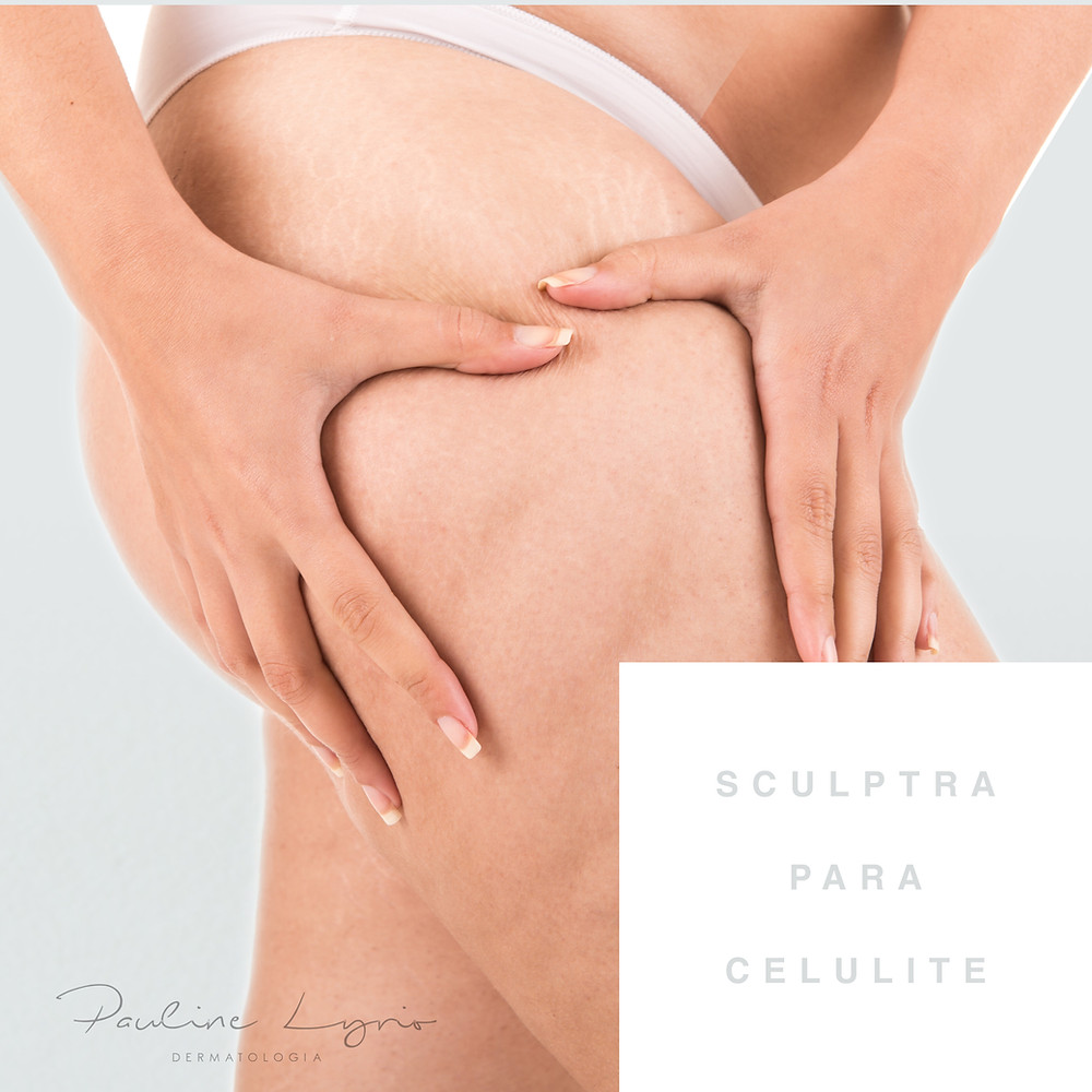 sculptra celulite estrias