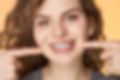 what-are-ceramic-braces.jpg