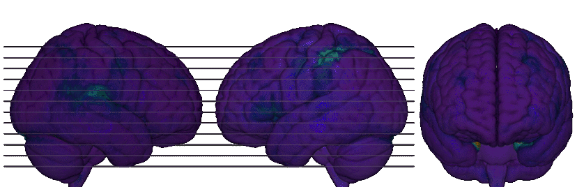 Brain-Dark.gif