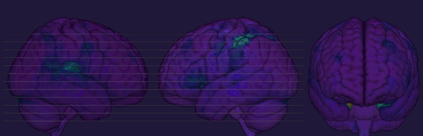 BrainDark.gif