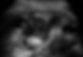 Xanthogranulomatous pyelonephritis in ultrasound