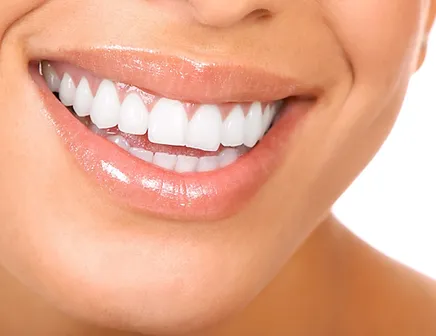 Diseno De Sonrisa Queretaro Dental Integral Baena