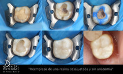 Reemplazo de Resina mal sellada